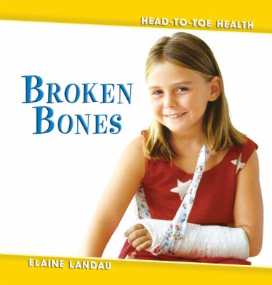 Broken bones cover image