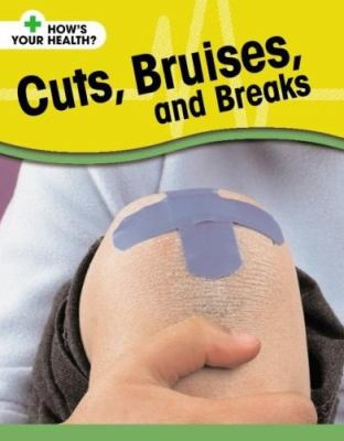Cuts, bruises, and breaks cover image