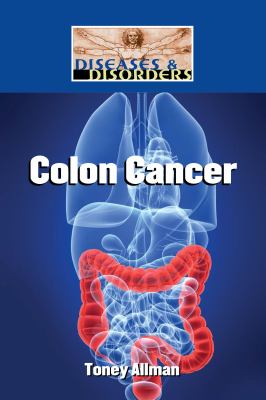 Colon cancer cover image
