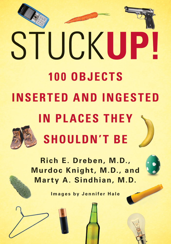 Stuck up! : 100 objects inserted and ingested in places they shouldn't be cover image
