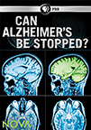 Can Alzheimer's be stopped? cover image
