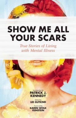 Show me all your scars : true stories of living with mental illness  cover image cdn