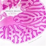 Broken brains cover image cdn