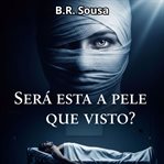 Será esta a pele que visto? cover image cdn